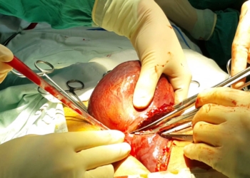 “2 ĐEN , 2 MÙI” TRÊN CƠ THỂ CẢNH BÁO GAN BỊ BỆNH RẤT NẶNG.