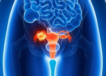 DẤU HIỆU NHẬN BIẾT UNG THƯ CỔ TỬ CUNG