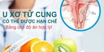 U xơ tử cung CÓ THỂ ĐƯỢC HẠN CHẾ bằng chế độ ăn hợp lý !!!
