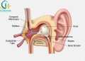 Cholesteatoma: “Kẻ Xâm Lấn” Thầm Lặng Trong Tai Giữa – Đừng Chủ Quan Với Chảy Mủ Tai Kéo Dài