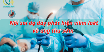 Nội soi dạ dày phát hiện viêm loét và ung thư sớm