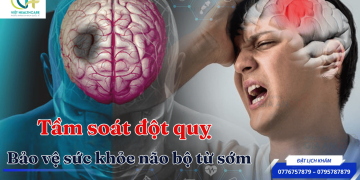 Tầm soát đột quỵ bảo vệ sức khỏe từ sớm