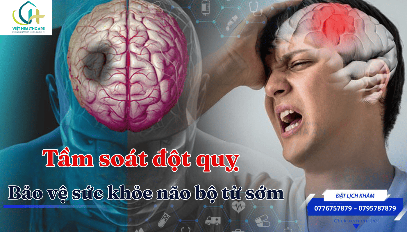 Tầm soát đột quỵ bảo vệ sức khỏe từ sớm