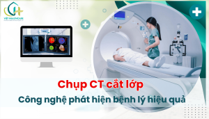Chụp CT cắt lớp: Công nghệ phát hiện bệnh lý hiệu quả