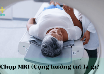 chup cong huong tu la gi