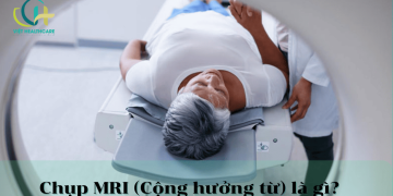 chup cong huong tu la gi