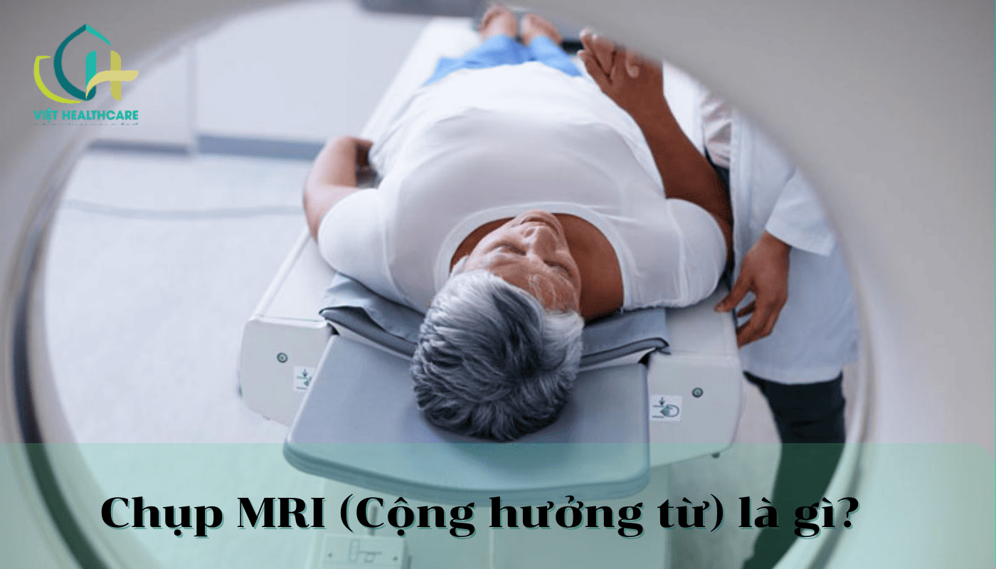 chup cong huong tu la gi