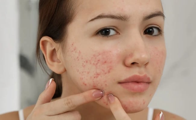 thuc khuya lam da noi mun