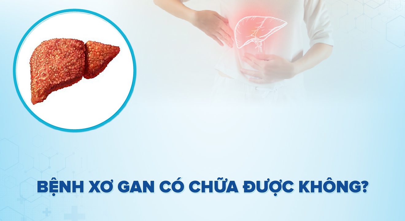 Bệnh xơ gan có chữa khỏi được không ?