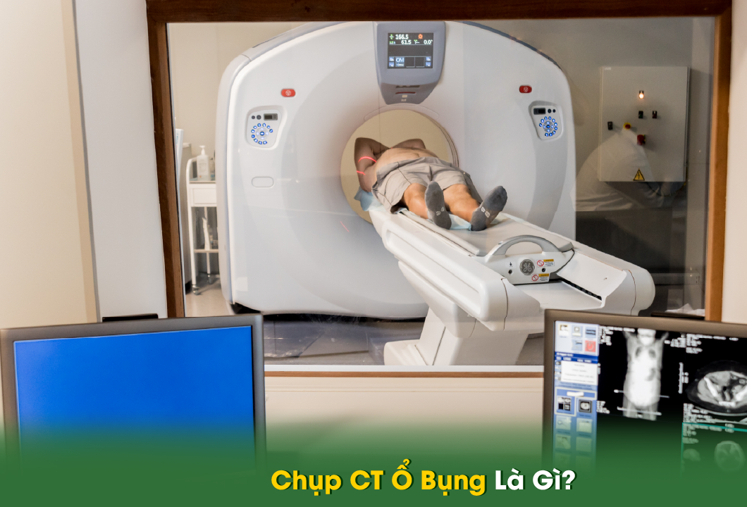 Chụp CT Ổ Bụng Có Cần Nhịn Ăn Không?