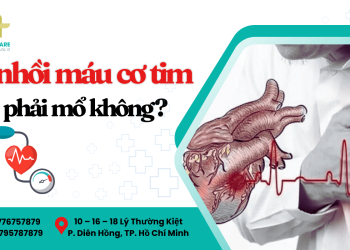 Bị nhồi máu cơ tim có phải mổ không?