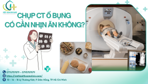 Chụp CT Ổ Bụng Có Cần Nhịn Ăn Không?