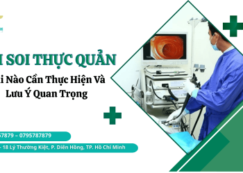 nên nội soi thực quản khong