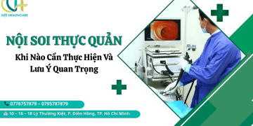 nên nội soi thực quản khong