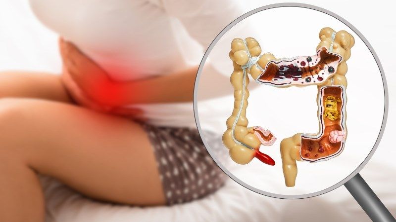 Nguyên nhân bị đường ruột
