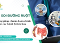 nội soi đường ruột