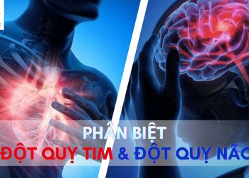 Phân biệt đột quỵ tim và đột quỵ não