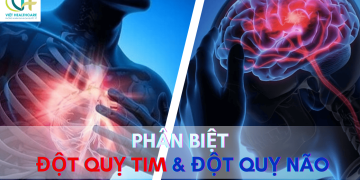Phân biệt đột quỵ tim và đột quỵ não