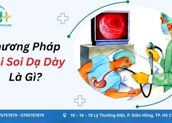 phuong phap noi soi da day