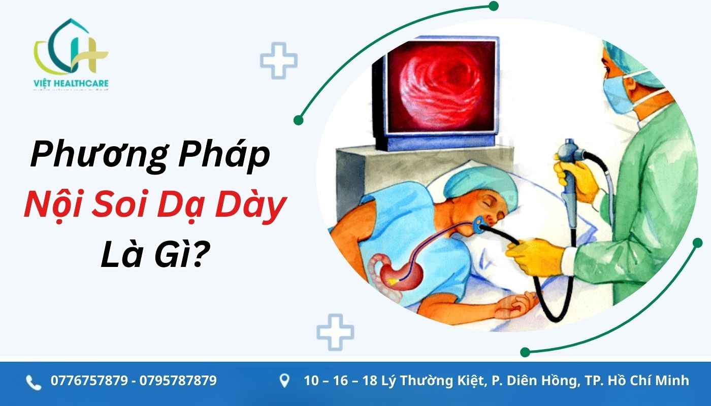 phuong phap noi soi da day