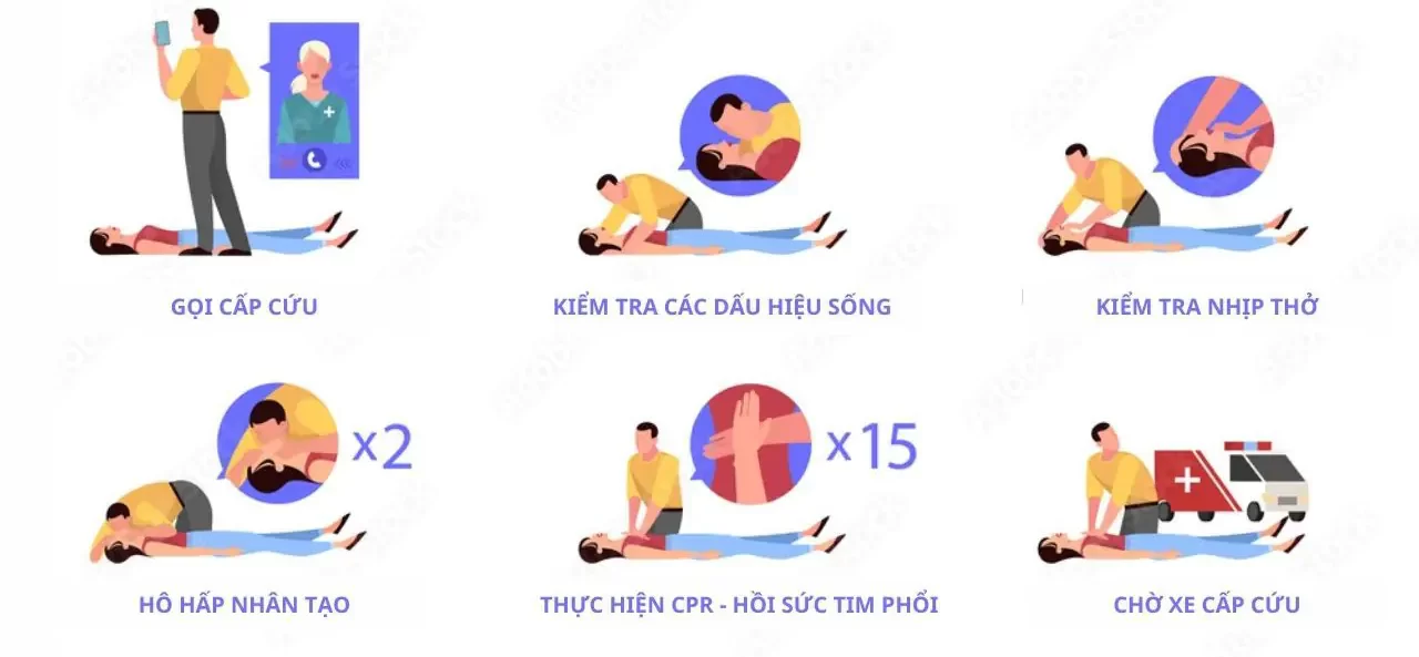 Cách sơ cứu đột quỵ tim