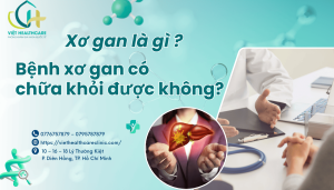 Xơ gan là gì ? Bệnh xơ gan có chữa khỏi được không ?
