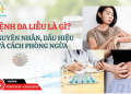 Bệnh Da Liễu Là Gì? Nguyên Nhân, Dấu Hiệu Và Cách Phòng Ngừa
