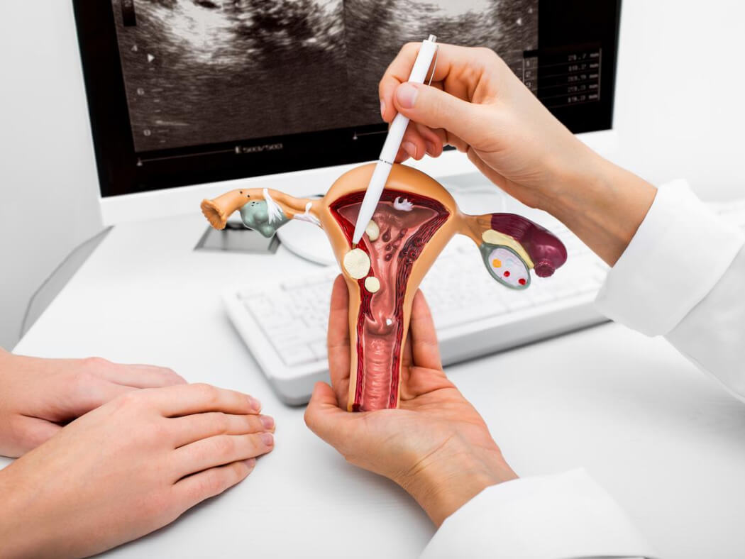 ung thư cổ tử cung