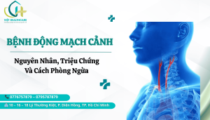 Bệnh động mạch cảnh