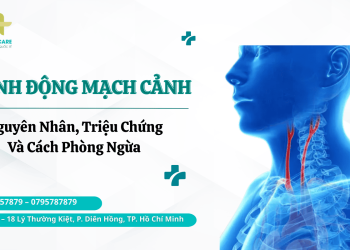 Bệnh động mạch cảnh