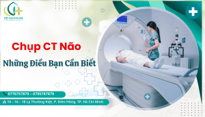 chụp CT não