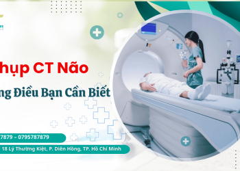 chụp CT não