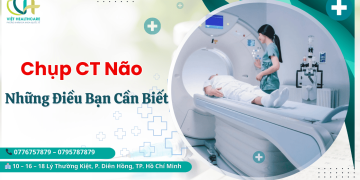 chụp CT não