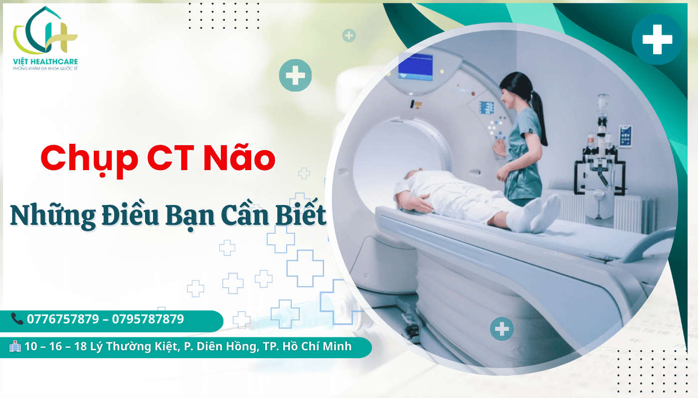chụp CT não