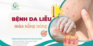 Các bệnh da liễu thường gặp trong mùa nắng nóng